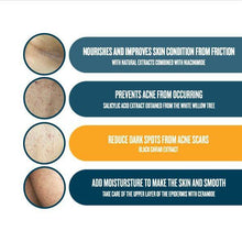 Load image into Gallery viewer, Nakiz Lively Butt Men Acne Dark Spots Skincare Cream 100 Gram