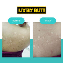 Load image into Gallery viewer, LIVELY BUTT + LIVELY SERUM SET